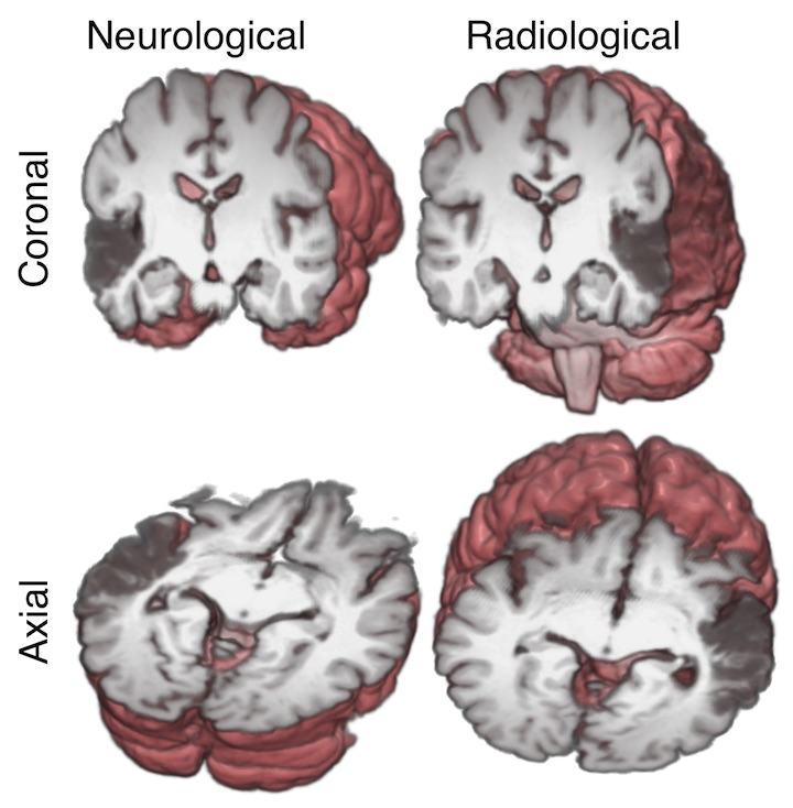 The-directions-that-the-neurologist-and-radiologist-are-thinking